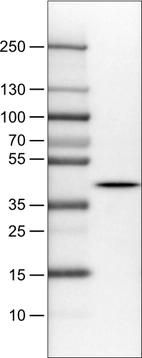 Lane 1: Marker [kDa]_br/_Lane 2: Human cerebral cortex lysate