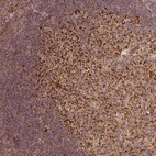Anti-PGAM5 Antibody