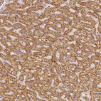 Immunohistochemical staining of human liver shows strong granular cytoplasmic positivity in hepatocytes.