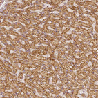 Anti-PGAM5 Antibody