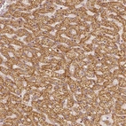 Immunohistochemical staining of human liver shows strong granular cytoplasmic positivity in hepatocytes.