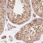 Immunohistochemical staining of human testis shows moderate to strong granular cytoplasmic positivity in cells in seminiferous ducts.