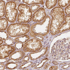 Immunohistochemical staining of human kidney shows strong granular cytoplasmic positivity in cells in tubules.