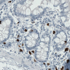 Anti-MMP9 Antibody