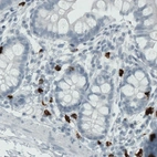 Immunohistochemical staining of human duodenum shows strong cytoplasmic positivity in a subset of lymphoid cells.