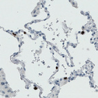 Anti-MMP9 Antibody