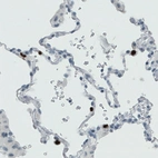 Immunohistochemical staining of human lung shows strong positivity in lymphoid cells.