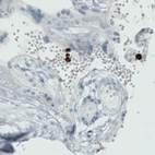 Immunohistochemical staining of human placenta shows strong immunoreactivity in granulocytes.