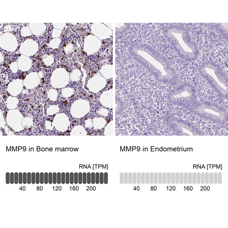 Anti-MMP9 Antibody