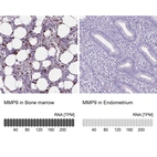 Anti-MMP9 Antibody