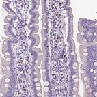 Immunohistochemical staining of human duodenum shows strong cytoplasmic positivity in lymphoid cells.