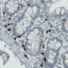 Immunohistochemical staining of human duodenum shows strong cytoplasmic positivity in a subset of lymphoid cells.
