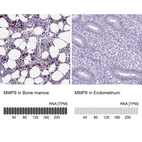 Anti-MMP9 Antibody