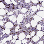 Anti-MMP9 Antibody