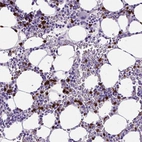 Immunohistochemical staining of human bone marrow shows strong cytoplasmic positivity in a subset of hematopoietic cells.