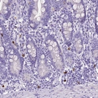 Immunohistochemical staining of human duodenum shows strong cytoplasmic positivity in lymphoid cells.