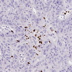 Anti-MMP9 Antibody