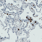 Anti-MMP9 Antibody