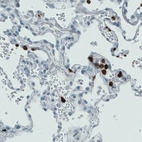 Immunohistochemical staining of human lung shows strong immunoreactivity in the macrophages and granulocytes.