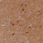 Anti-NECAB2 Antibody