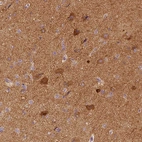 Immunohistochemical staining of human cerebral cortex shows moderate to strong cytoplasmic positivity in neurons.