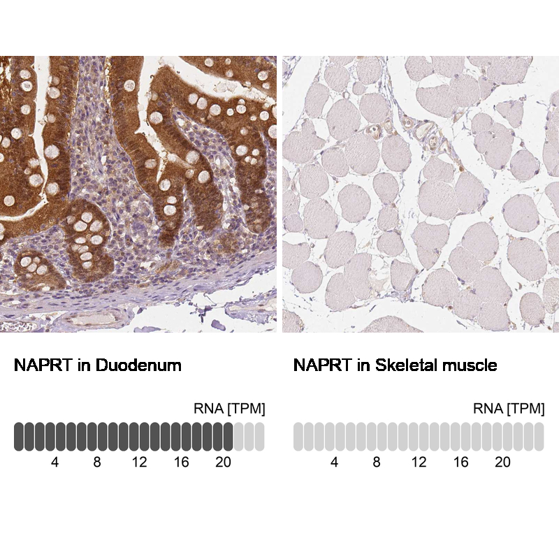 Anti-NAPRT Antibody