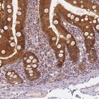 Immunohistochemical staining of human duodenum shows strong cytoplasmic positivity in glandular cells.