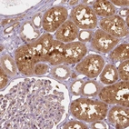 Immunohistochemical staining of human kidney shows strong cytoplasmic positivity in cells in tubules.