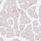 Immunohistochemical staining of human skeletal muscle shows no positivity in myocytes as expected.