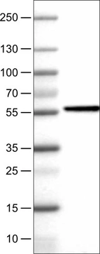 Lane 1: Marker [kDa]_br/_Lane 2: Human liver tissue lysate