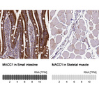 Anti-MACC1 Antibody