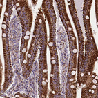 Anti-MACC1 Antibody