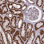Immunohistochemical staining of human kidney shows strong cytoplasmic positivity in cells in tubules.