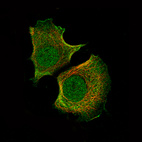 Immunofluorescence staining of MCF7 cells using the Anti-AKT1 monoclonal antibody, showing specific staining in the nucleus, cytosol and plasma membrane in green. Microtubule- and nuclear probes are visualized in red and blue, respectively (where available).