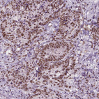 Anti-BRD4 Antibody