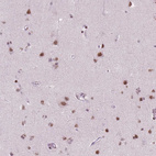Immunohistochemical staining of human cerebral cortex shows moderate nuclear positivity in neuronal cells.