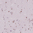 Anti-BRD4 Antibody