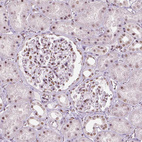 Anti-BRD4 Antibody