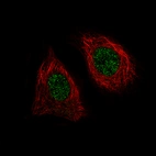 Immunofluorescence staining of MCF-7 cells using the Anti-BRD4 monoclonal antibody, showing specific staining in the nucleoplasm in green. Microtubule- and nuclear probes are visualized in red and blue, respectively (where available).