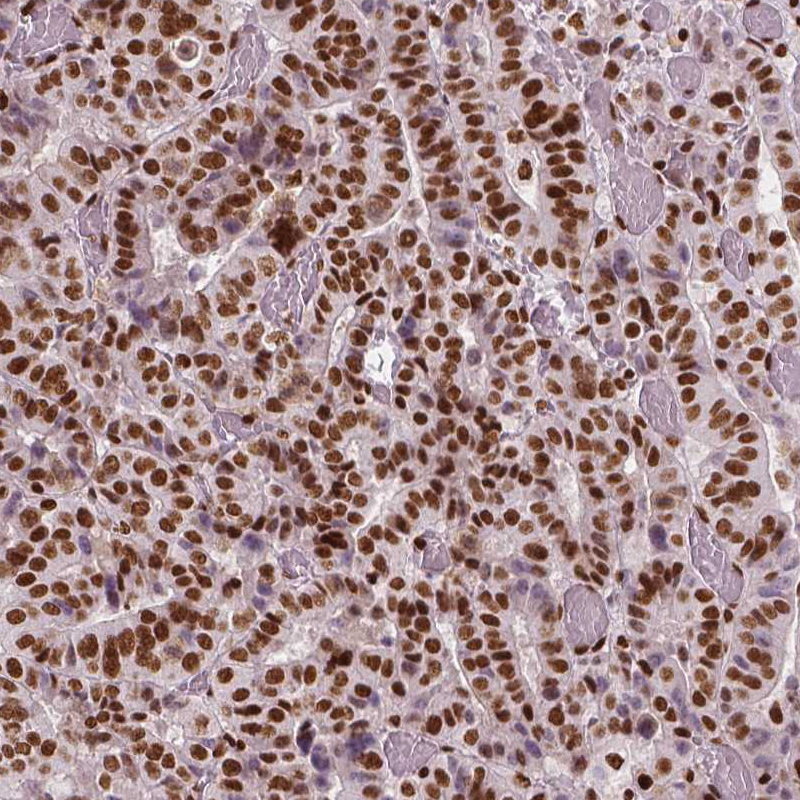 Anti-BRD4 Antibody