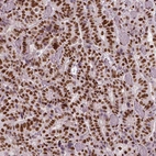 Anti-BRD4 Antibody