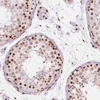 Immunohistochemical staining of human testis shows moderate to strong nuclear positivity in cells in seminiferous ducts.