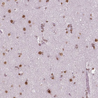 Anti-BRD4 Antibody