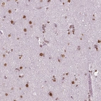 Immunohistochemical staining of human cerebral cortex shows moderate to strong nuclear positivity in neurons.