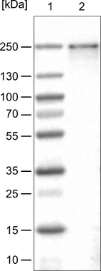 Lane 1: Marker [kDa]_br/_Lane 2: Human cell line U-251 MG