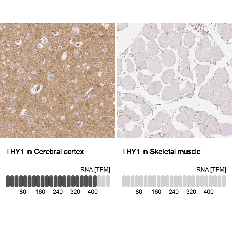 Anti-THY1 Antibody