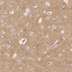 Immunohistochemical staining of human cerebral cortex shows moderate positivity in neuropil.