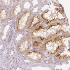 Immunohistochemical staining of human kidney shows moderate to strong positivity in apical membranes in cells in tubules.