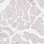 Immunohistochemical staining of human skeletal muscle shows no positivity in myocytes as expected.
