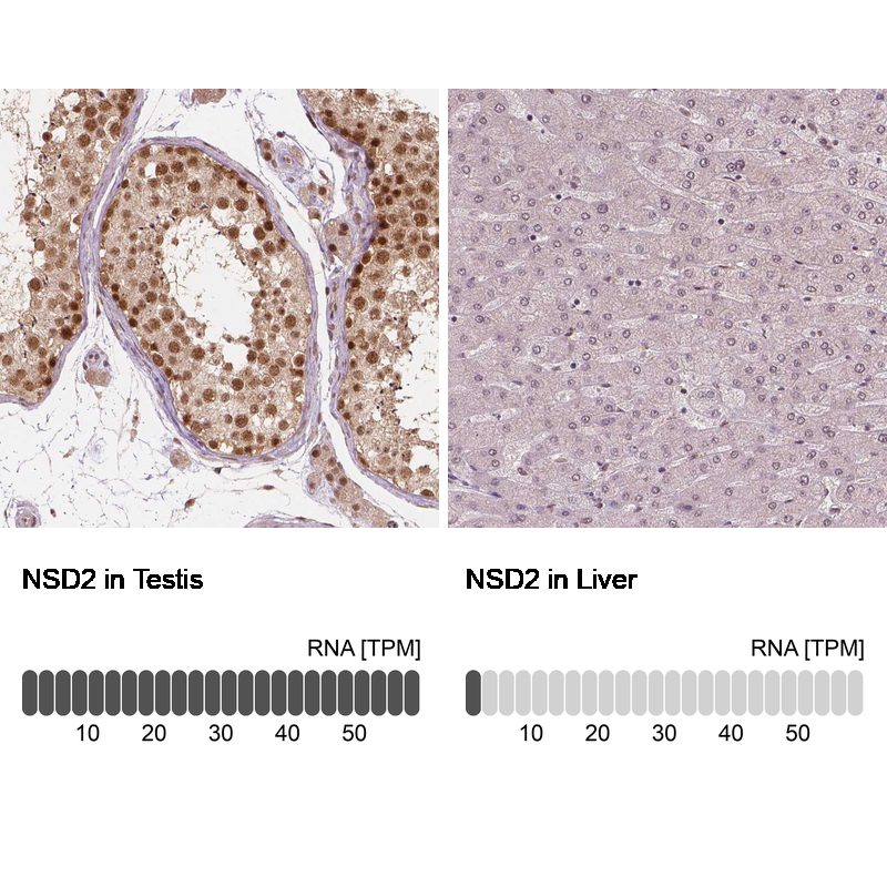 Anti-NSD2 Antibody